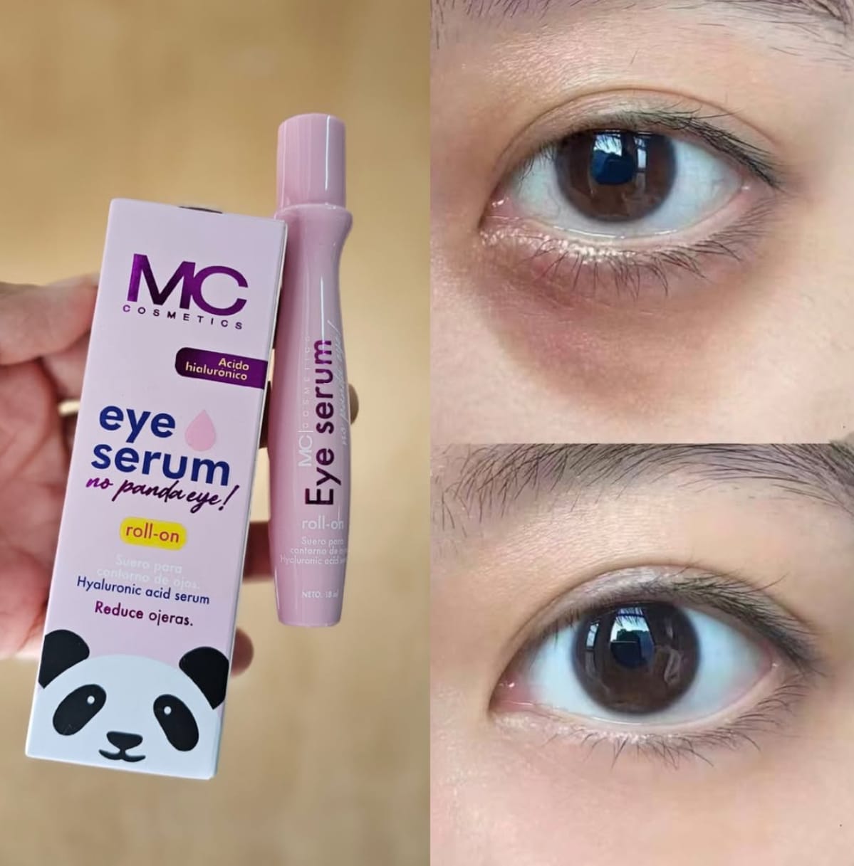 para el Contorno de ojos Eye Serum