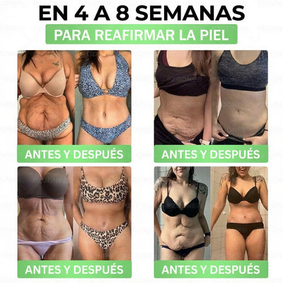 𝑳𝒖𝒙𝒂𝒓𝒊𝒔𝒆/ Moringa & Berberina 2X1