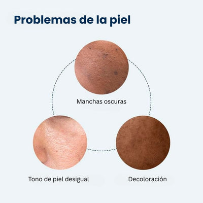 REMEDY Para Corregir Manchas Oscuras 2X1