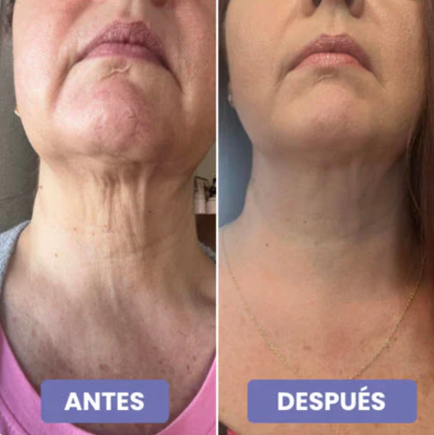 Crema antienvejecimiento para el cuello