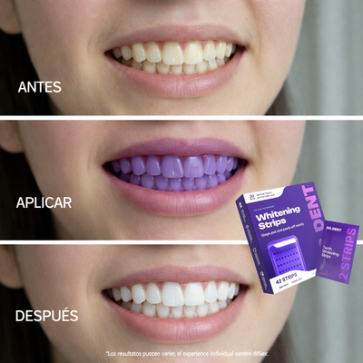 Tiras Blanqueadoras de Dientes