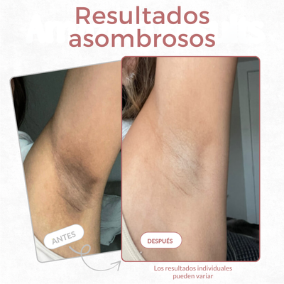 Spray exfoliante corporal