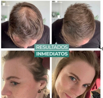 Natural Fibras Para Cabello Fino