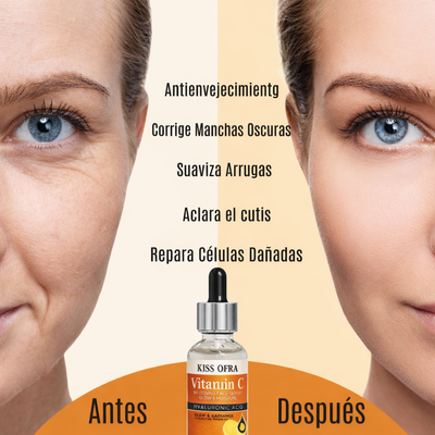 Suero Facial Blanqueador con Vitamina C
